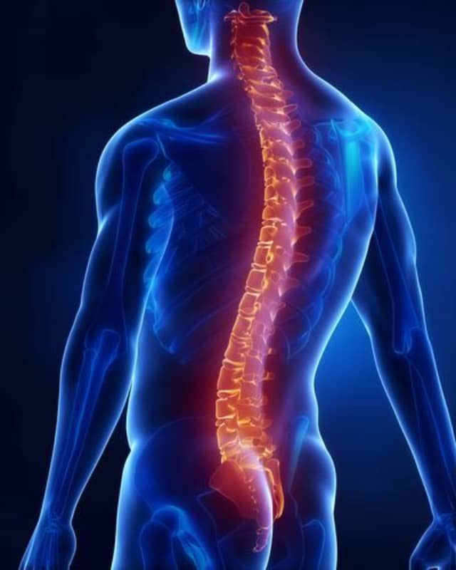 spinal cord stimulation
